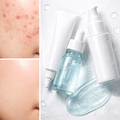 Acne Treatment Products – Clear & Healthy Skin